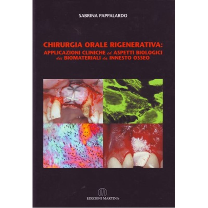 CHIRURGIA ORALE RIGENERATIVA: applicazioni cliniche ed aspetti biologici dei biomateriali da innesto osseo